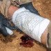 Бандаж MARCH Battle Bandage